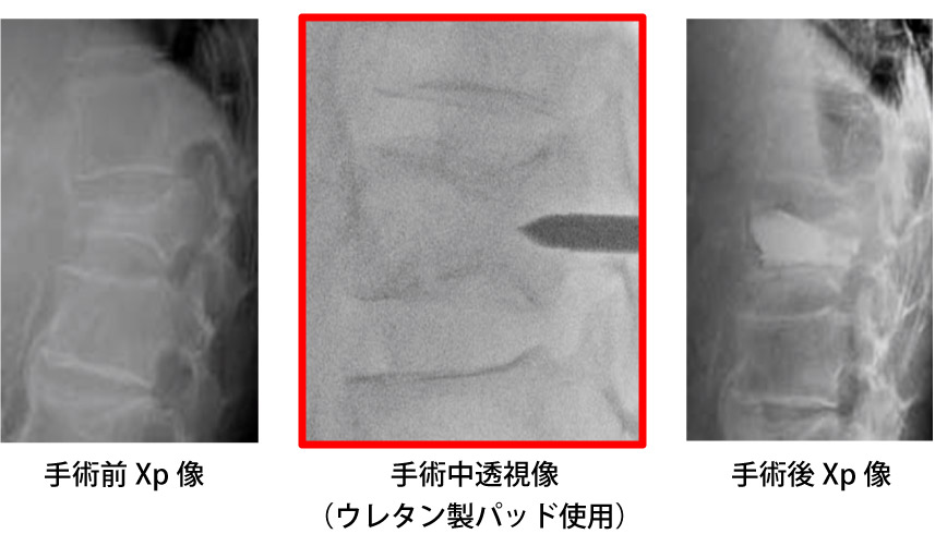 低反発クッション+硬ウレタンセット